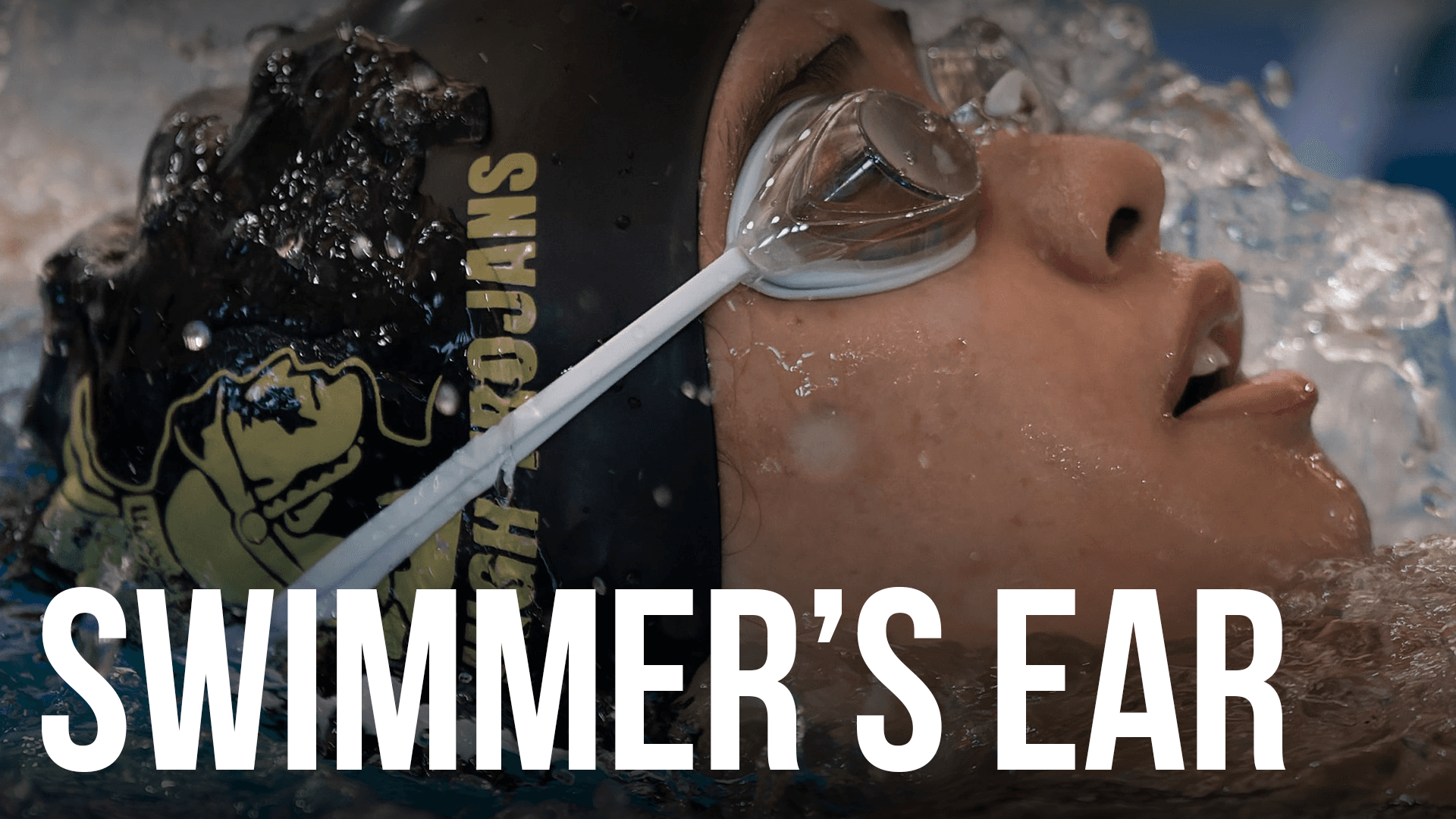 Youth Inc. Recommends: Five Resources to Help You Understand, Manage, and Prevent Swimmer’s Ear